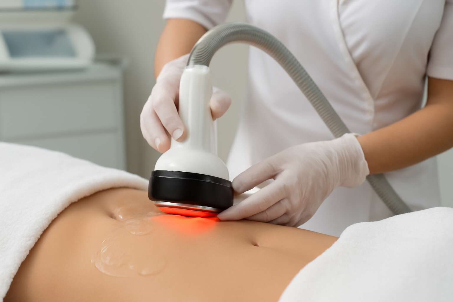 what is laser lipo cavitation