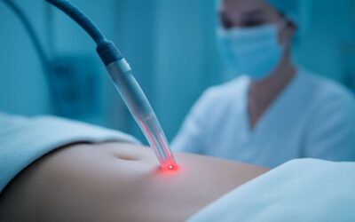 What you should know about laser lipo does it work: real results and risks.