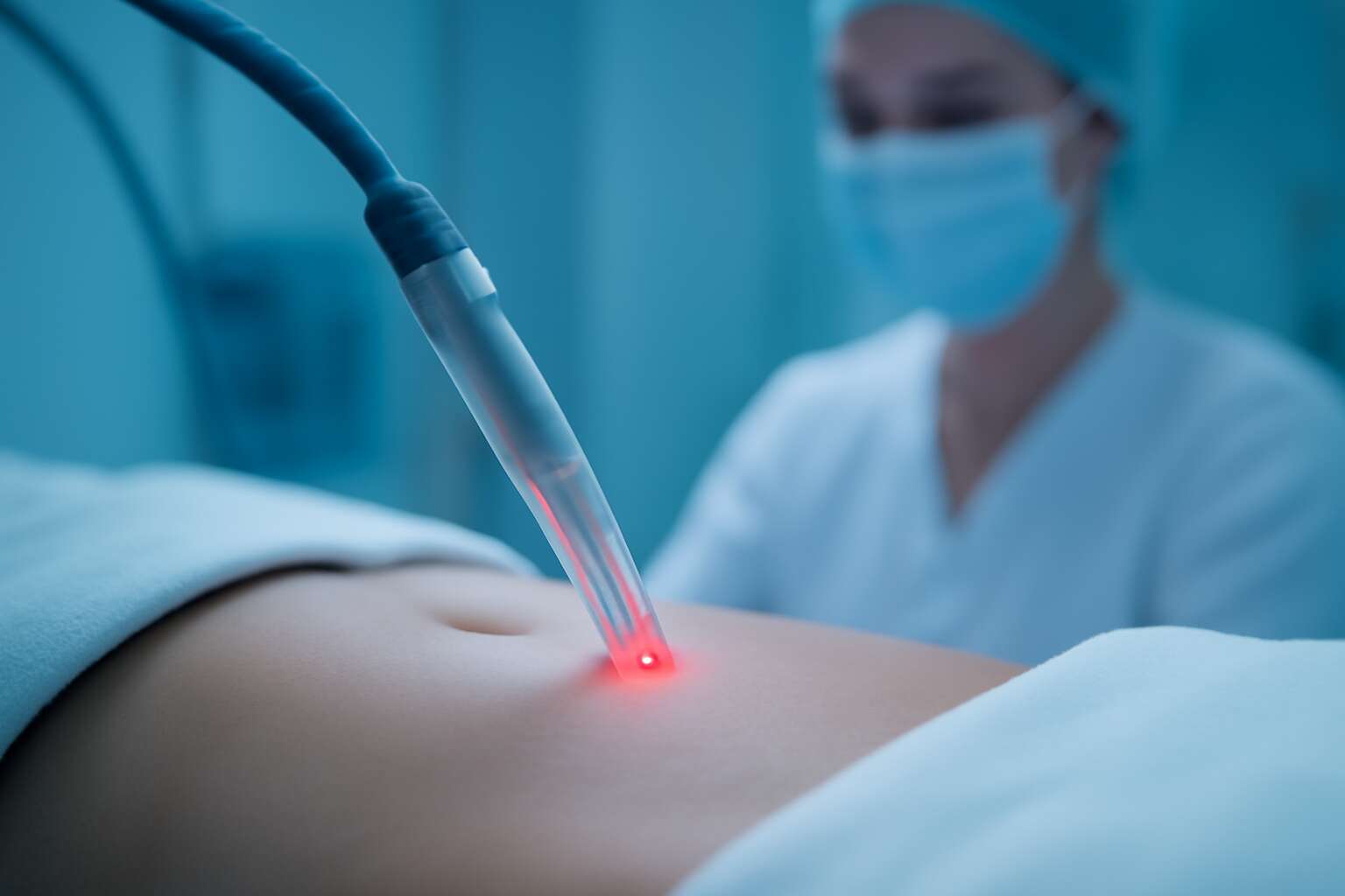 laser lipo does it work